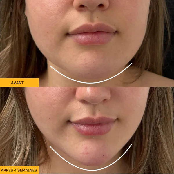 Brosse-sculptante & drainage lymphatique