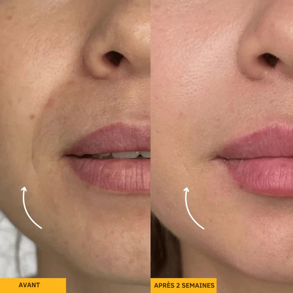 Brosse-sculptante & drainage lymphatique